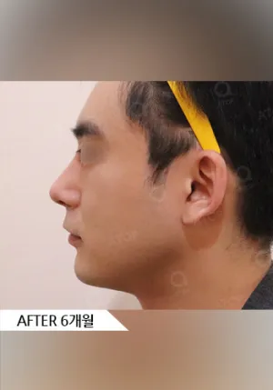 After