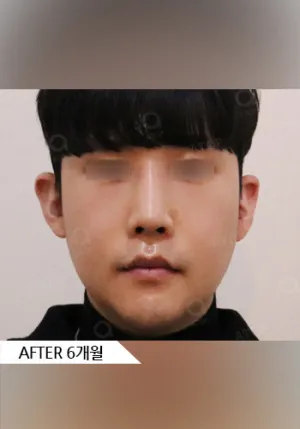 After