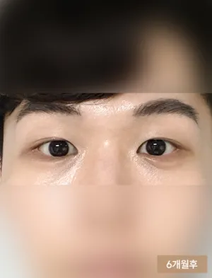 After
