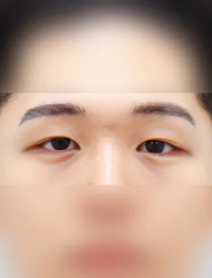Before