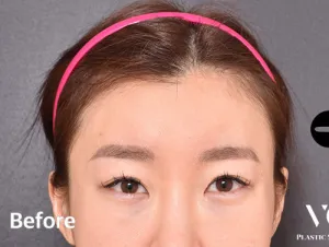 Before