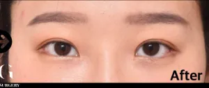 After