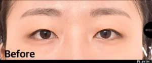 Before