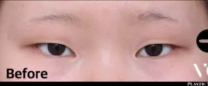 Before