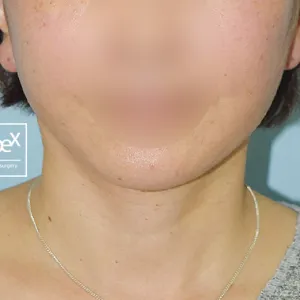 After