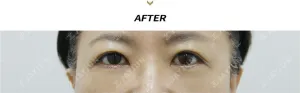 After