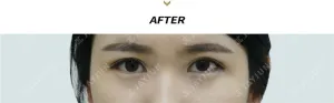 After