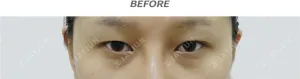 Before
