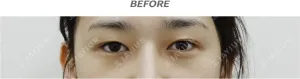 Before