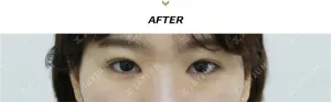 After