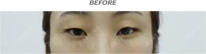 Before