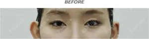 Before