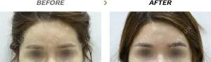 Before