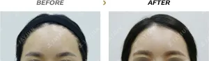 Before