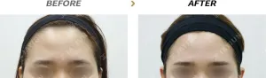 Before