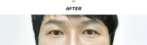 After