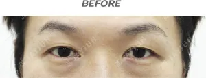 Before