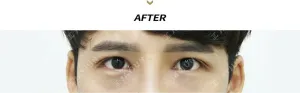 After