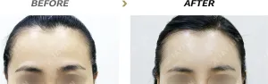Before