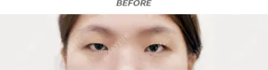 Before