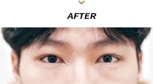 After