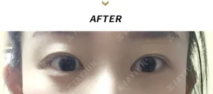 After