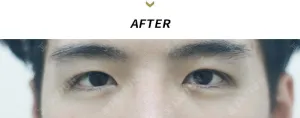 After
