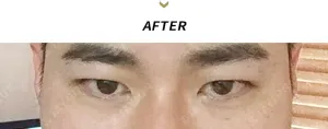 After