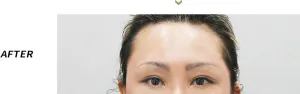 After