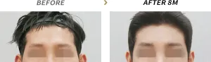 Before