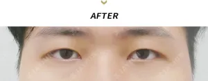 After