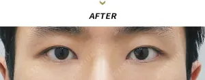 After