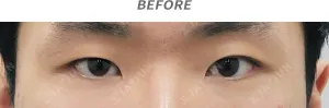 Before