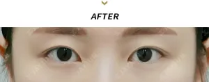 After