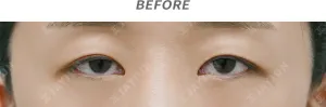 Before