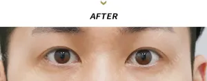 After