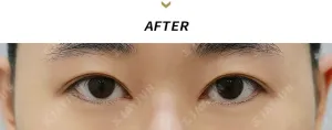 After