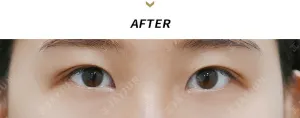After