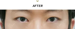 After
