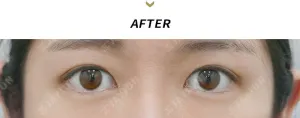 After
