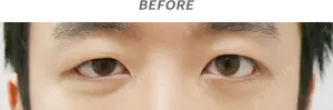 Before