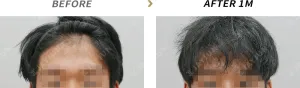 Before