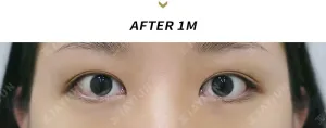 After