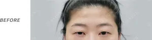 Before