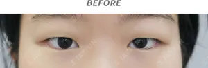 Before