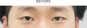 Before