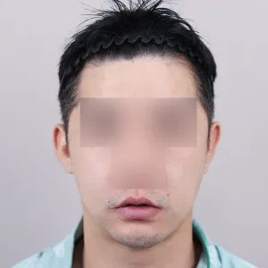 After