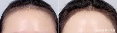 Before & After