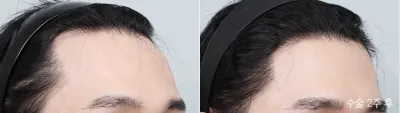 Before & After