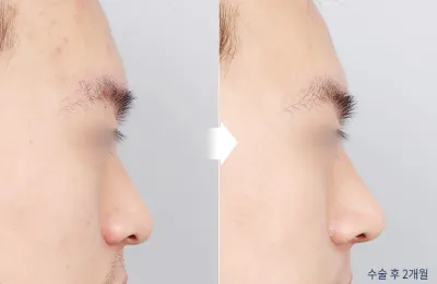 Before & After